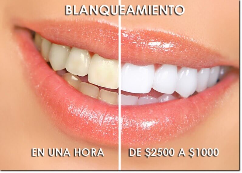 Clínica Dental Spota — consultorio profesional en Puebla